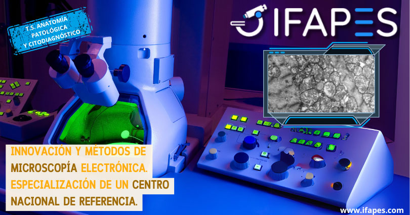Innovación y métodos de Microscopia electrónica. Especialización de un centro nacional de referencia