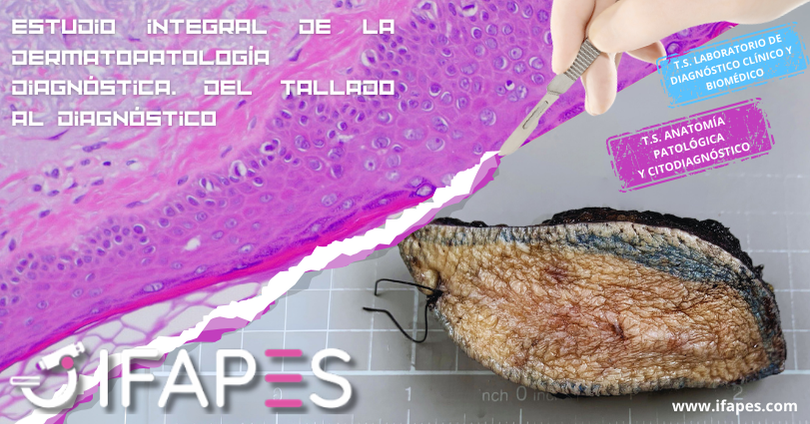 Estudio integral de la Dermatopatología diagnóstica. Del Tallado al Diagnóstico.